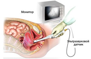 Cum se administrează uzii transvaginali ai organelor pelvine în timpul sarcinii