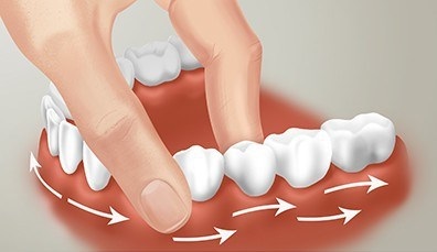 Cum să întăriți guma cu slăbirea dinților