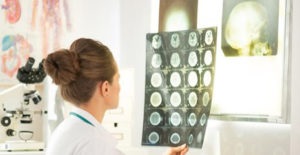 MRI az agy