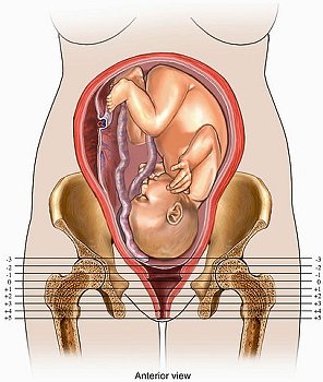 Osteoporoza fetală 30 de săptămâni, 30 săptămâni de sarcină