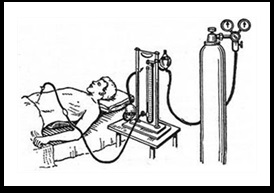 Pneumoperitoneu în clinica de tuberculoză