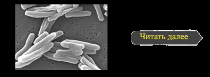 Pneumoperitoneu în clinica de tuberculoză