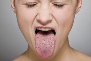 Miért szájszárazság éjjel okokat és megoldásokat, a lehetséges betegségek kezelésére és hasznos