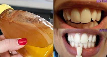 Clătiți gura cu un singur ingredient simplu și vedeți ce se întâmplă cu dinții