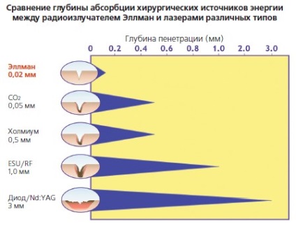 Radiosurgery și posibilitățile sale în stomatologie