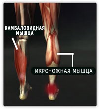 Gyakorlatok az alsó lábszár izmait, erősítő edzés