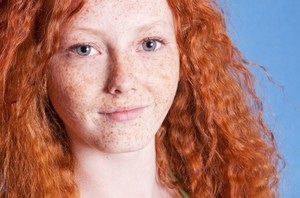 Freckles cum să scapi de video pentru totdeauna - ziua femeii