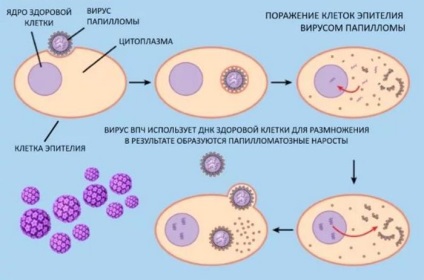 Human papillomavirus în timp ce este transmis