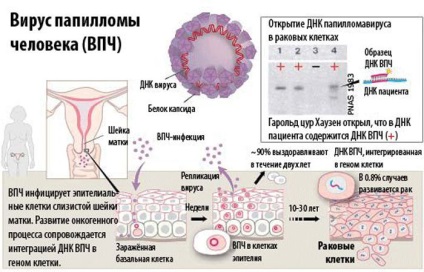 Human papillomavirus în timp ce este transmis