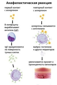 Simptome de soc anafilactic, diagnostic, tratament