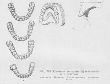 Dispozitive de acționare funcțională (pasivă), stomatologie ortopedică