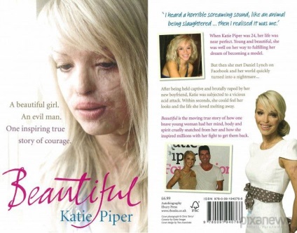 Szörnyű történet Katie Piper, umkra