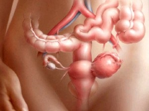 Dysherminomul ovarian prezintă o oncologie feminină dată, onkostatus