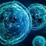 Dysherminomul ovarian prezintă o oncologie feminină dată, onkostatus