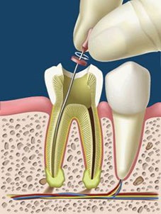 Endodonția și stomatologia endodontică