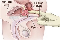 Erectie in timpul masajului, orgasmului si ejacularii