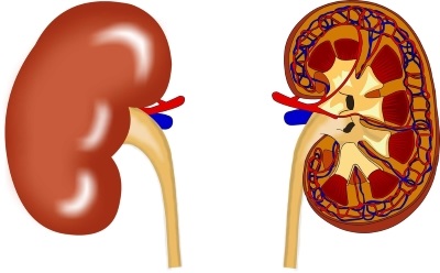 Hydronephrosis a cauzelor de rinichi, grade și etape, tratament (ceea ce este și rezultatul bolii)