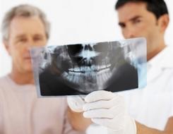 Istoria dezvoltării implantologiei dentare
