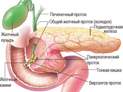 Pietrele cauzate de pancreas, simptomele și tratamentul calcificărilor fără intervenție chirurgicală