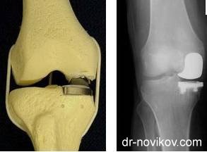 Clinica de Traumatologie Sportivă și Ortopedie în Kiev, Centrul de Reabilitare