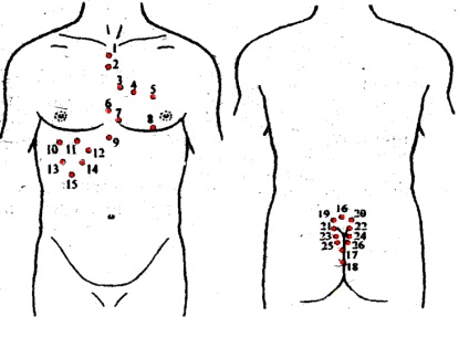 Tratamentul cu lipitori de insuficiență cardiacă