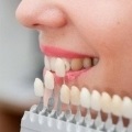 Extinderea prețului dinților de la 800 de fre