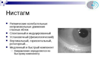 Nystagmus determină apariția tratamentului spontan, orizontal și vertical, congenital, spontan