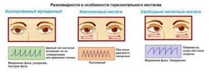 Nystagmus okok gorizotalnogo és függőleges, veleszületett, spontán, kezelés