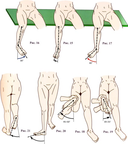 Rotația axială a articulației genunchiului - fiziologia articulațiilor, articulația genunchiului - chirurgie și tratament