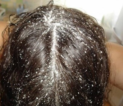 Măștile de păr simple la domiciliu ajută buclele rapide și eficiente