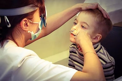 Az orrmelléküreg-gyulladás a gyermek (orrmelléküreg-gyulladás, ethmoiditis, arcüreggyulladás) - különösen a patológia, kezelési stratégiát, kölyök