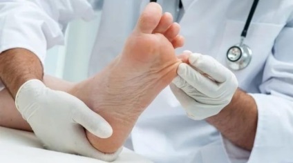 Clorhexidina din ciuperca unghiilor de pe picioare, regulile de aplicare și contraindicații