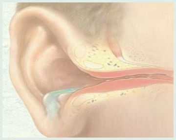 ENT betegségek (sinusitis, otitis)