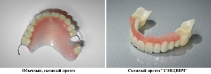 Proteine ​​dentare caracteristici sandwich, beneficii, preturi