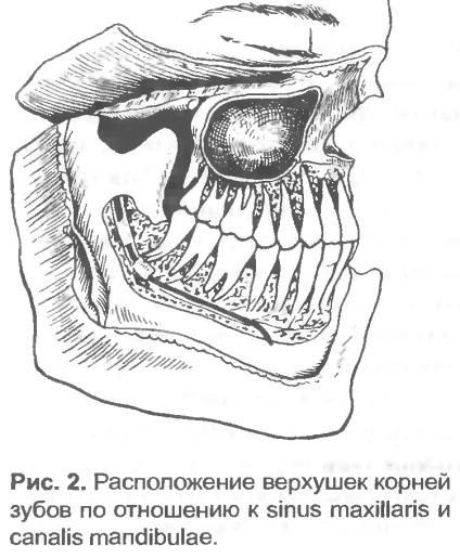 Съзъбие апарати - добра стоматологична портал, добра зъбна портал