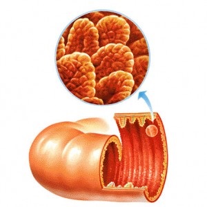 Duodenită simptome cronice și medicație medicamente și remedii folk, dieta