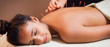 Acupunctura pentru revizuiri de greutate, indicații, contraindicații, rezultate