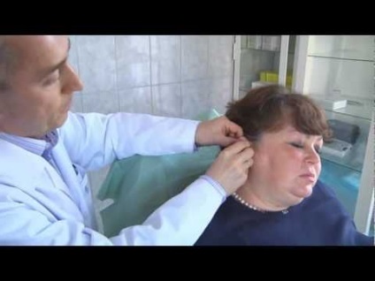 Acupunctura pentru revizuirea pierderii in greutate, puncte pentru pierderea in greutate si contraindicatii