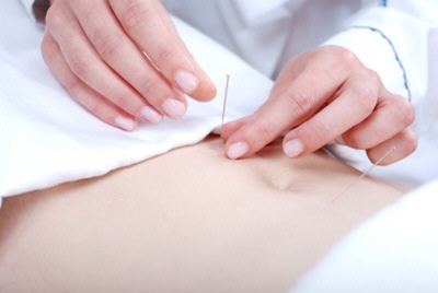 Acupunctura este o modalitate eficienta de a pierde in greutate