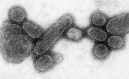 Spanyolnátha „- influenza, hogy az emberek soha nem fog elfelejteni