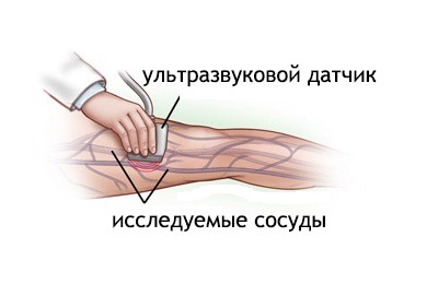 Cum să verificați navele întregului corp și corpul de cercetare și diagnostice, verificarea stării și