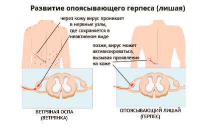 Cine este vectorul de varicela si care este sursa infectiei