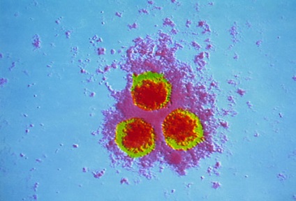 Cine este vectorul de varicela si care este sursa infectiei