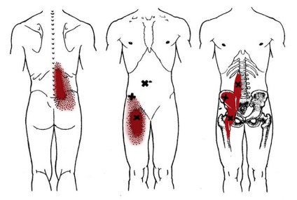 Tratamentul durerii de la nivelul mușchiului lombosacral în centrul medical 
