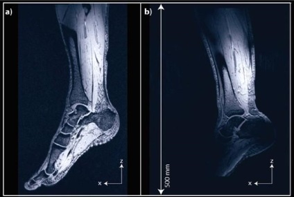 A technika MRI berendezés típusú tanulmányok Szentpéterváron Ramsey diagnosztika