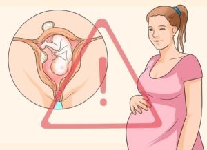 Pot să rămân gravidă cu miom uterin?
