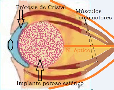 Orgital patologie