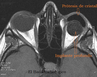 Orgital patologie