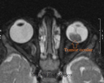 Orgital patologie