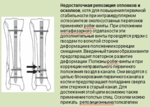 Hibák a gyakorlatban a traumatológus ortopéd